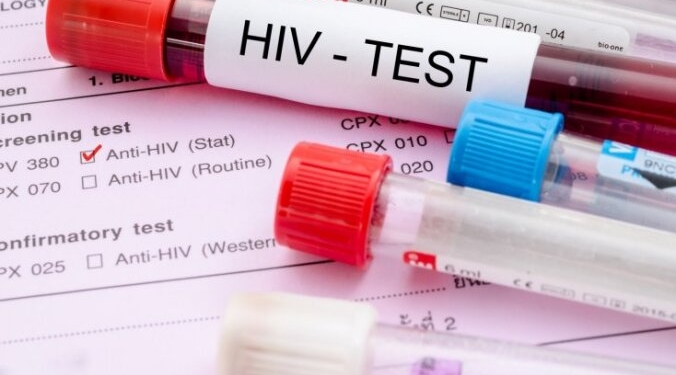 В Нидерландах выявлен новый, более опасный вариант ВИЧ