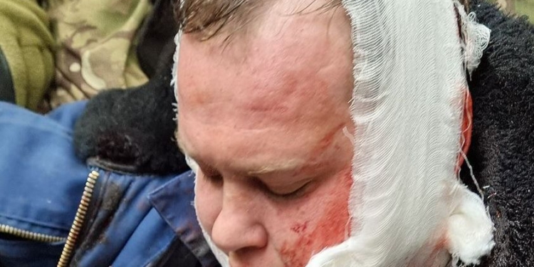 На Черниговщине сбили вражеский самолет, пилоты катапультировались, но не ушли (ФОТО, ВИДЕО)