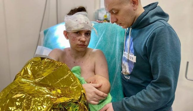 Украинская Мадонна: в Киеве мать спасла ребенка, закрыв его своим телом от обстрела