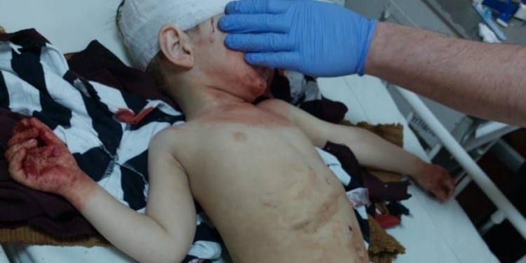 Нелюди: російські окупанти обстріляли з «Градів» колону людей, які евакуйовувались з Маріуполю, – є загиблі і поранені діти (ФОТО)