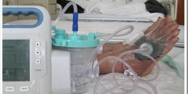 МОЗ закупило 800 аппаратов для высокоэффективного лечения ран