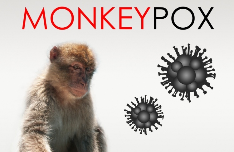 США оголосили віспу мавп надзвичайною ситуацією в галузі охорони здоров’я