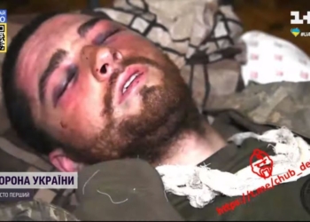 17 дней адской боли, а вместо обезболивания — русские новости. Со сломанным тазом и осколками в глазах рашисты держали в плену нашего  морпеха без медпомощи (ФОТО, ВИДЕО)