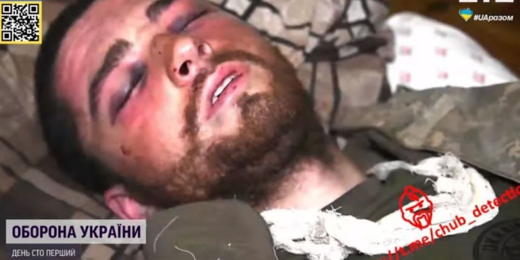 17 дней адской боли, а вместо обезболивания — русские новости. Со сломанным тазом и осколками в глазах рашисты держали в плену нашего  морпеха без медпомощи (ФОТО, ВИДЕО)