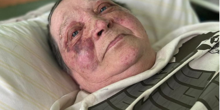 У Херсоні окупанти зламали хребет 70-річній волонтерці через відмову здати паспорт