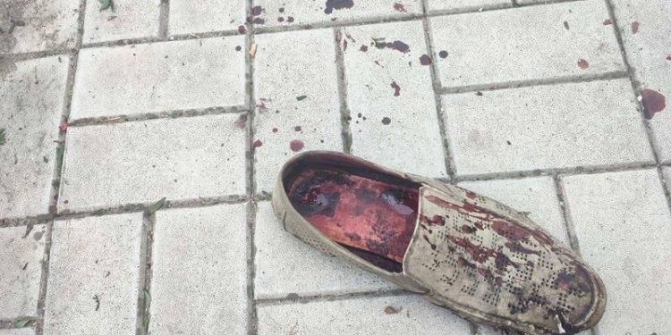 Кількість поранених внаслідок ранкового обстрілу Миколаєва збільшилась майже вдвічі – голова облради