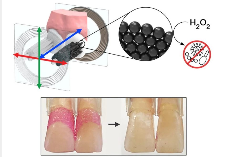 Нанороботы вместо зубной пасты - американские ученые изобрели новый способ чистить зубы 1