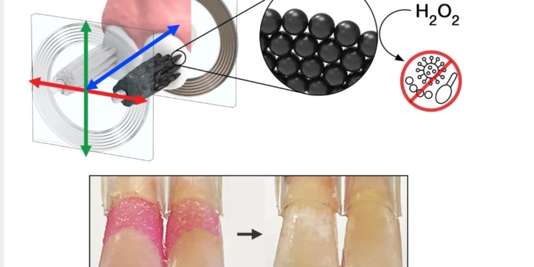 Нанороботы вместо зубной пасты – американские ученые изобрели новый способ чистить зубы