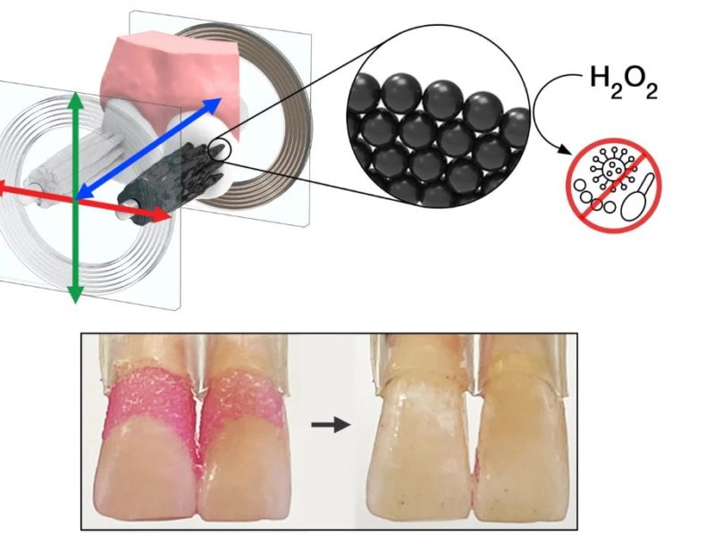 Нанороботы вместо зубной пасты – американские ученые изобрели новый способ чистить зубы