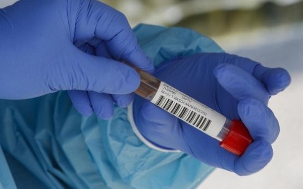 За тиждень в Миколаєві захворіли на ковід 30 мешканців