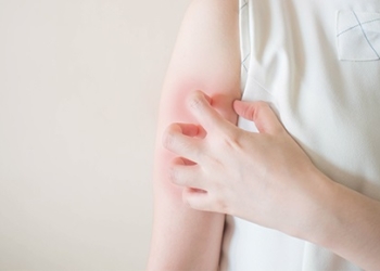 Атопічний дерматит: 5 причин для профілактичного візиту до лікаря