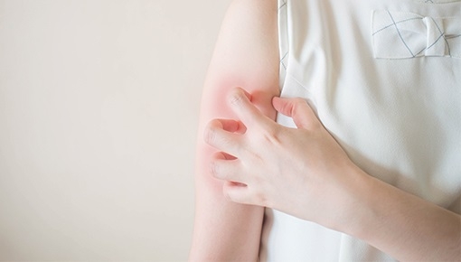 Атопічний дерматит: 5 причин для профілактичного візиту до лікаря