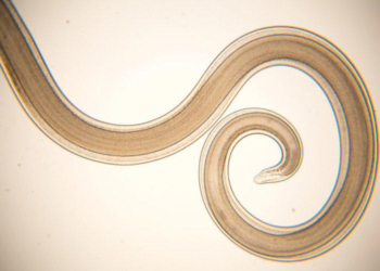 У Рівному з голови жінки витягнули 10-сантиметрового гельмінта