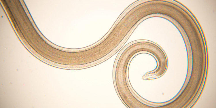 У Рівному з голови жінки витягнули 10-сантиметрового гельмінта