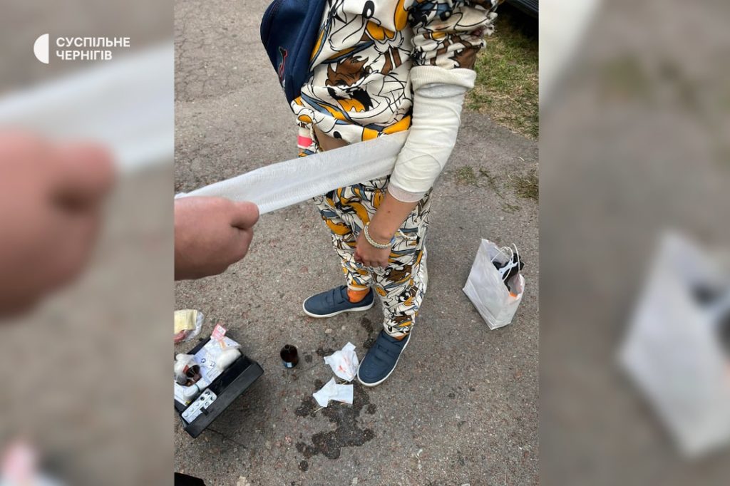 В Чернігові на виставці боєприпасів пролунав вибух – троє дітей поранено (ФОТО) 3