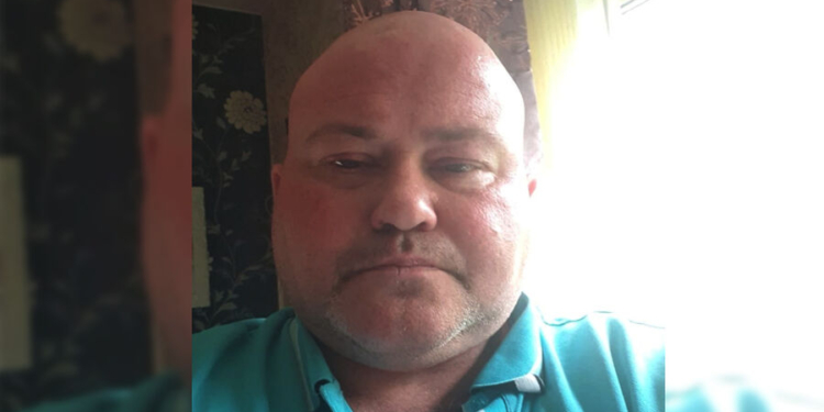 Рашисти повернули тіло британського волонтера, який ніби-то помер в полоні від стресу. На ньому численні порізи та сліди тортур