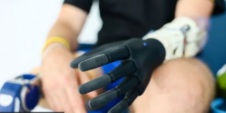 Сталеві люди. Як військовим повертають ноги і руки, втрачені на війні з Росією