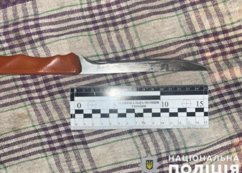 На Миколаївщині після сварки під час застілля 55-річний чоловік опинився в лікарні з ножовим пораненням живота (ФОТО)