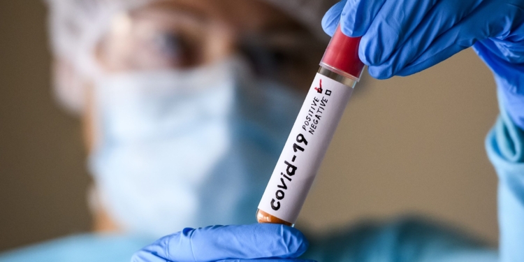 В Німеччині вважають, що пандемія коронавірусу закінчилась