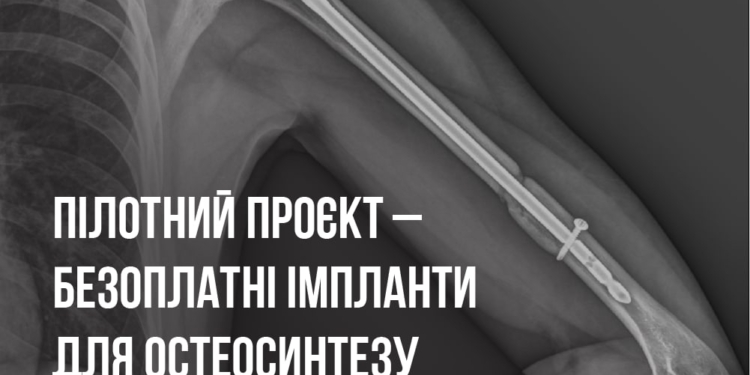 В трьох українських лікарнях українцям, які постраждали внаслідок війни, будуть безоплатно ставити імпланти для остеосинтезу