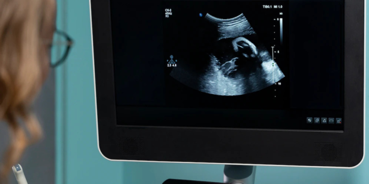 Роль УЗ-диагностики в лечении бесплодия