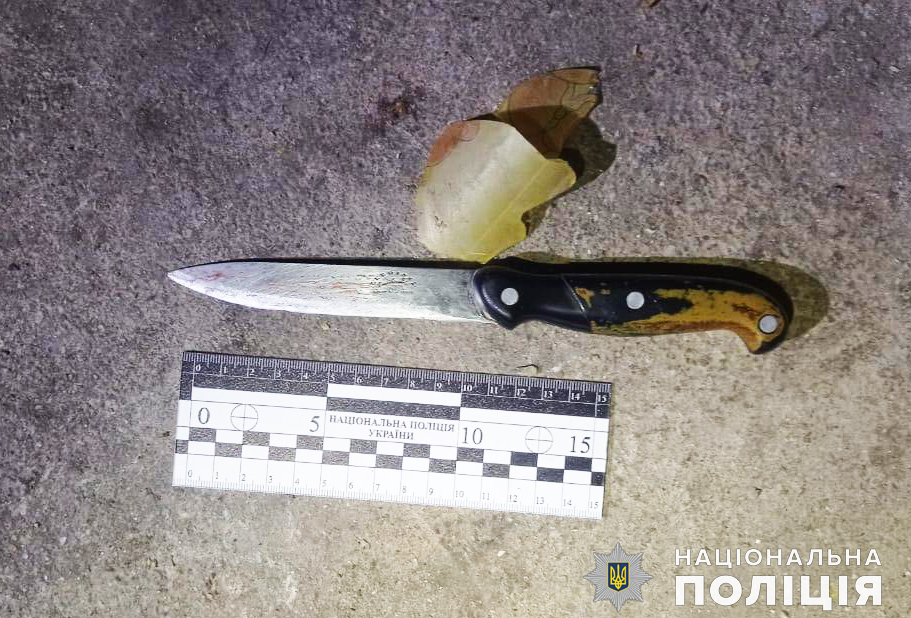 Святкували день народження: на Миколаївщині іменинник кілька разів вдарив свого гостя ножем 24