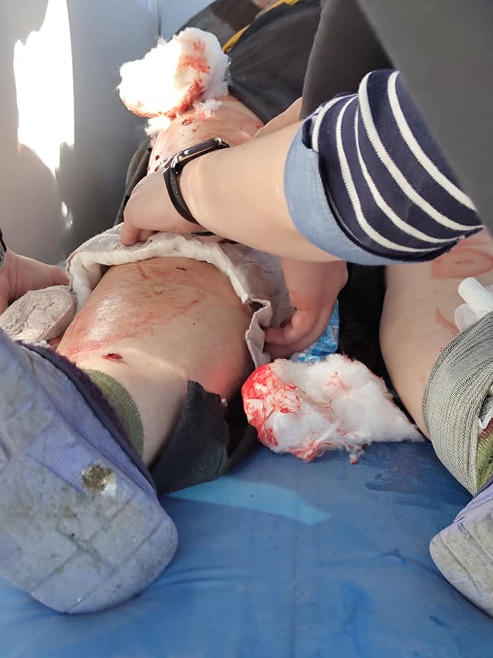 На Миколаївщині одеські волонтери-медики врятували жінку, поблизу якої вибухнув російський снаряд (ФОТО) 1