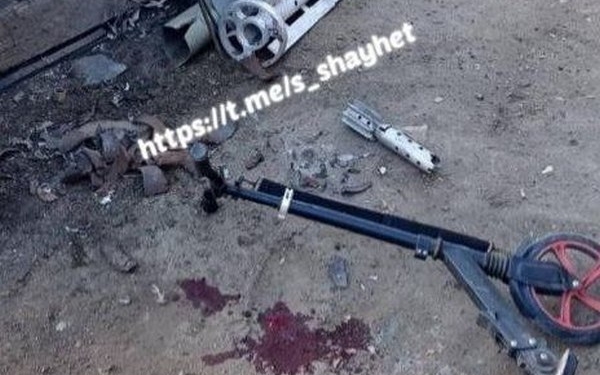 В селі під Миколаєвом на касетному боєприпасі підірвався 9-річний хлопчик (ФОТО)