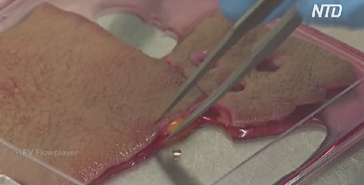 Британські вчені розробили невидимі пластирі для прискорення загоєння ран (ВІДЕО)