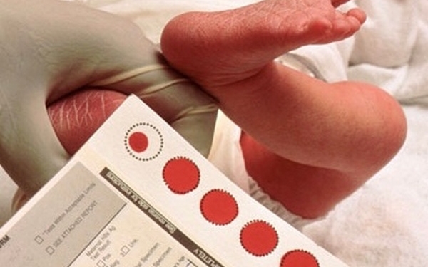 У Миколаєві за 3,5 місяця перевірили 610 новонароджених на рідкісні захворювання: які результати