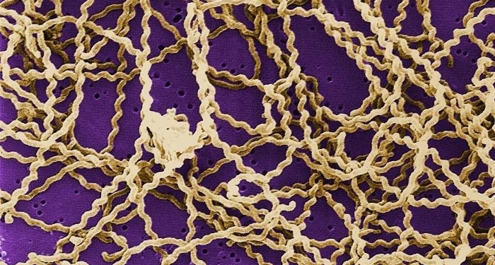 У Первомайську на Миколаївщині від лептоспірозу померла одна людина