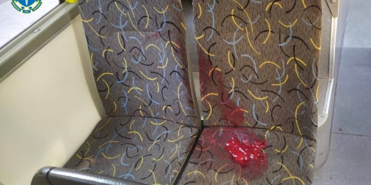 Росіяни зранку обстріляли Херсон: відомо про 8 поранених (ФОТО)