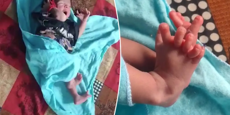 Богиня. В Індії народилася дівчинка з 26 пальцями. Родина в захваті (ФОТО)