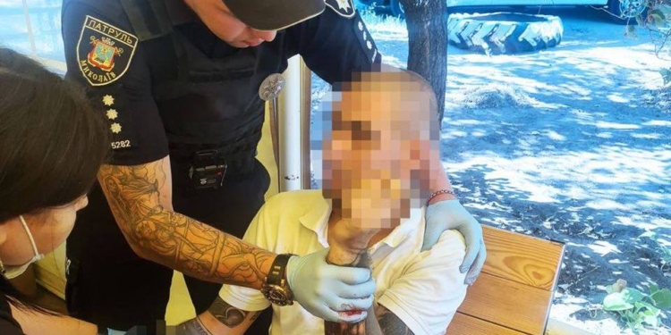 У Миколаєві патрульні зупинили кровотечу у громадянина, який намагався вкоротити собі віку (ФОТО)