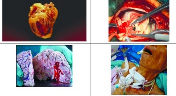Жахливі картинки: Уряд скасував діючі норми щодо маркування пачок сигарет – МОЗ показало, що буде їх «прикрашати» з січня 2024 року