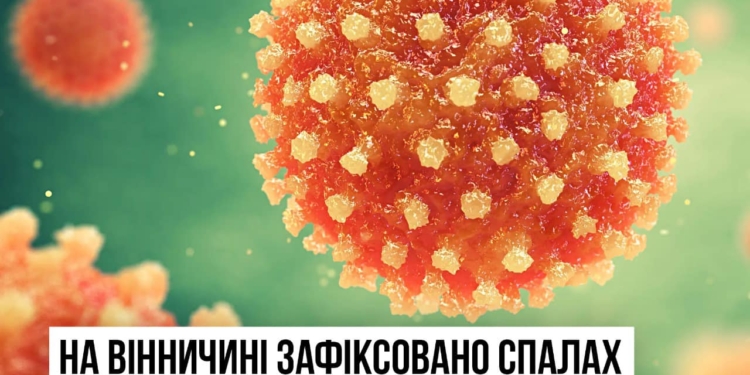 На Вінниччині зафіксовано спалах вірусного гепатиту А – 60 людей госпіталізовано