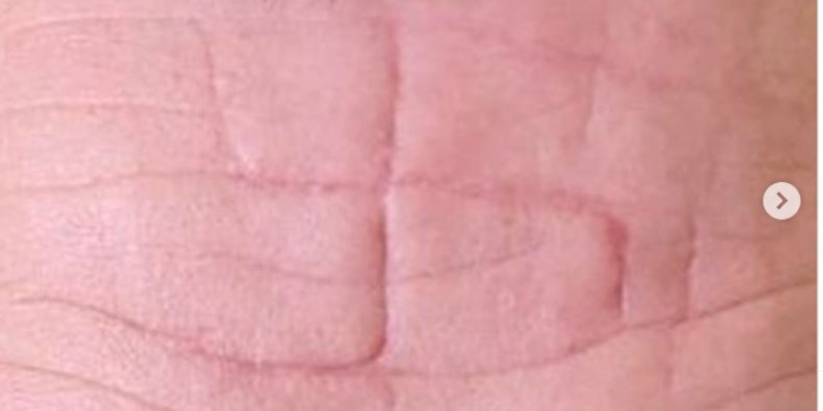 Окупанти вирізали свастику на лобі полоненого українського бійця. Що казали (ФОТО)