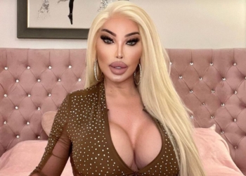 Біда. Бджола вкусила у сідницю людину-“барбі” і пробила імплантат (ФОТО)