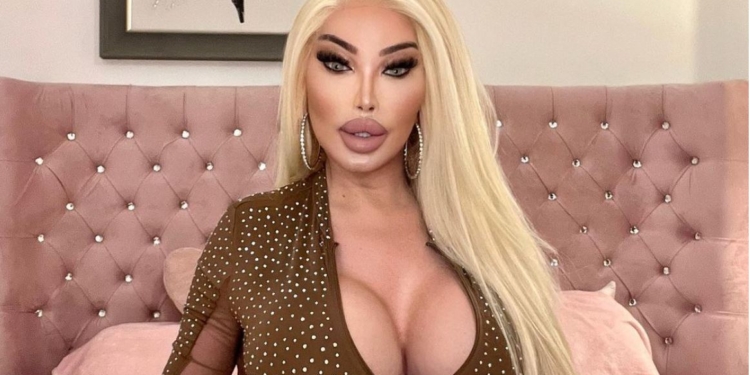 Біда. Бджола вкусила у сідницю людину-“барбі” і пробила імплантат (ФОТО)