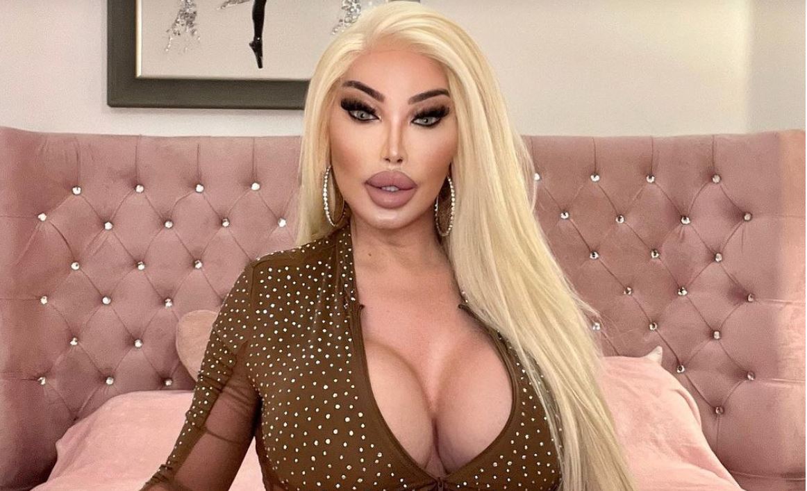 Біда. Бджола вкусила у сідницю людину-“барбі” і пробила імплантат (ФОТО)