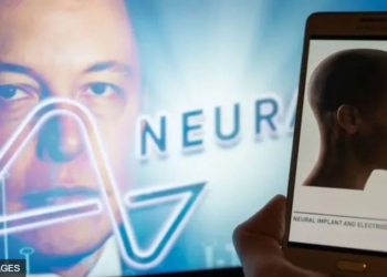 Компанія Маска вживила чип у мозок людини. Каже – пацієнту сподобалось