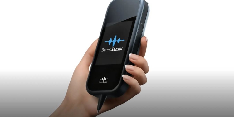 ШІ на сторожі здоров’я. Сенсор для виявлення раку шкіри на ранній стадії вже працює (ВІДЕО)