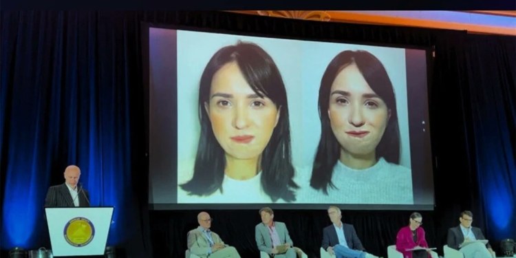 Закрила собою двох синів під час російського бомбардування: мешканці Миколаївщини польські лікарі відновили обличчя (ФОТО)