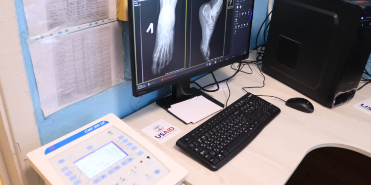 У Новоодеській лікарні на Миколаївщині завдяки гранту з’явився новий рентген-апарат (ФОТО)