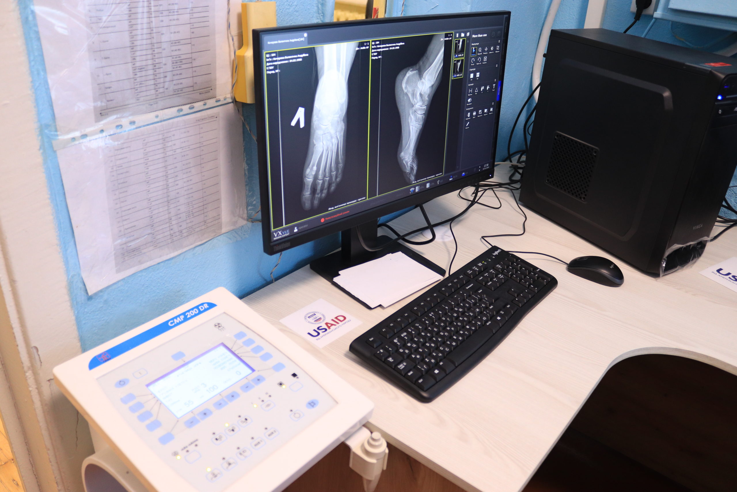 У Новоодеській лікарні на Миколаївщині завдяки гранту з’явився новий рентген-апарат (ФОТО)