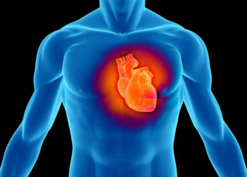 infarkt