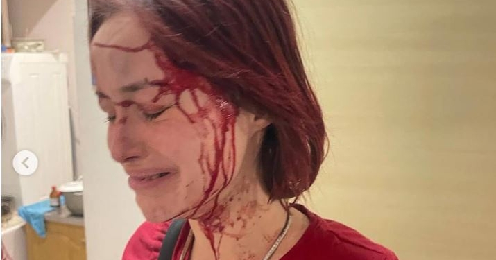 Скандал в Одесі. На дівчину нібито напав військовий на милицях з ТЦК, а перед тим таксист з балончиком. Що там було насправді?