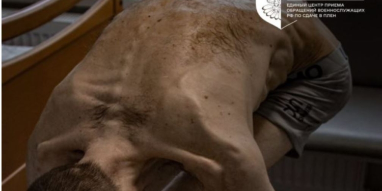 Звільнений з російського полону українець шокував світ своїм виглядом (ФОТО)