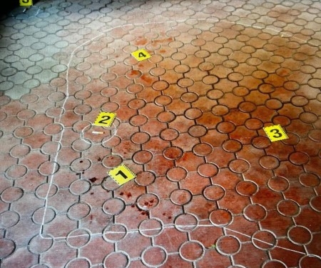 Майже «класика»: у Миколаєві двоє товаришів по чарці щось не поділили, тепер один – в лікарні з ножовим пораненням