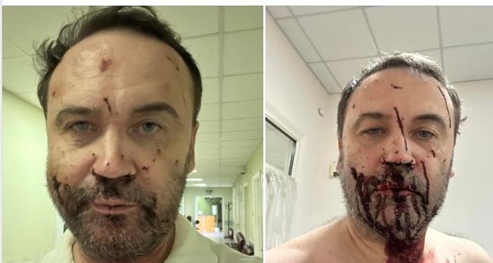 Ілля Пономарьов розповів, як пережив замах дронів на його життя (ФОТО)